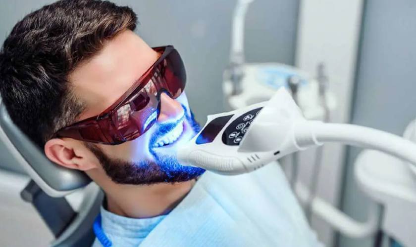 Tẩy trắng răng tại nha khoa bằng laser có hiệu quả không?