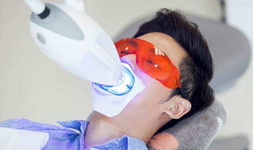 Quy trình tẩy trắng răng mất bao lâu?